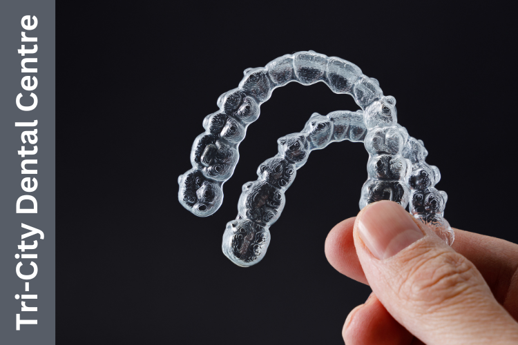 Invisalign in Coquitlam: A Clear Path to a Straighter Smile