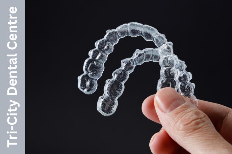 Invisalign® in Coquitlam: The Complete Guide to Clear Aligners