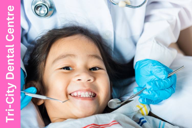 dental sealants Coquitlam