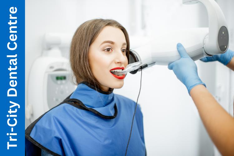dental X-rays Coquitlam