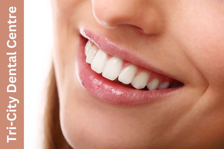 teeth shifting treatment Coquitlam